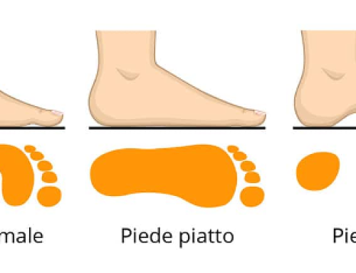 Piede piatto/cavo